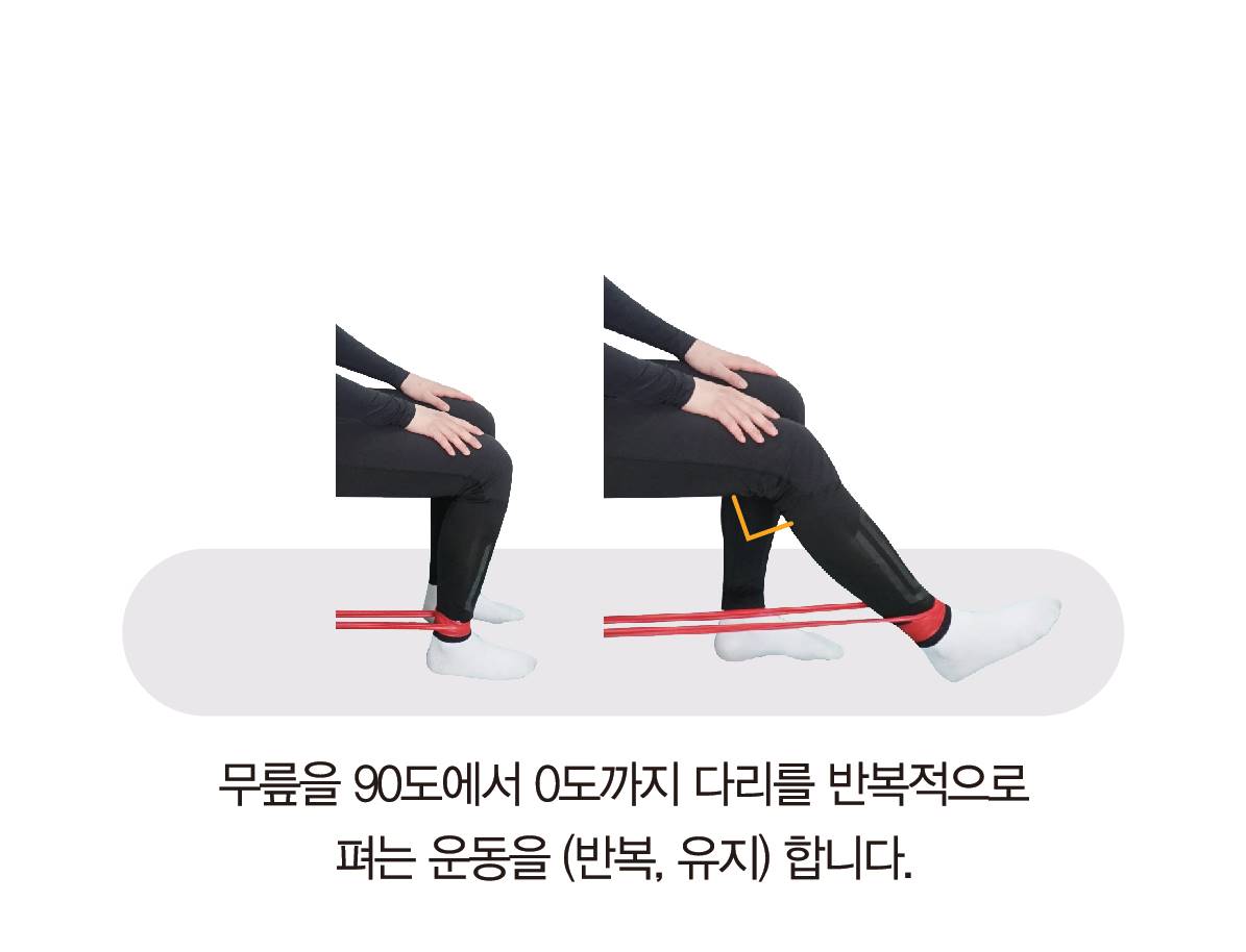 가벼운 무릎 통증 무시 말아야…원인 찾아 치료·관리를 - 중앙일보헬스미디어